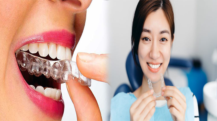 What Are the Benefits of SureClear Aligners and SureSmile Technology?